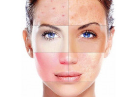Типы кожи и способы определения к какому типу относится ваша кожа